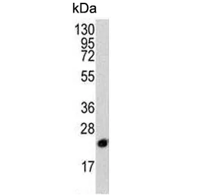 PEBP1 Antibody / PBP / RKIP - image 1