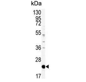 PEBP1 Antibody / PBP / RKIP - image 1