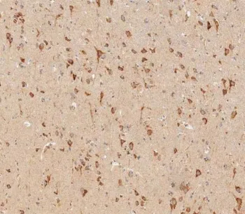 IFNAR1 Antibody / Interferon alpha receptor 1 - image 1