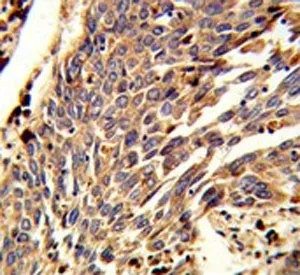 ARPC1B Antibody - image 1