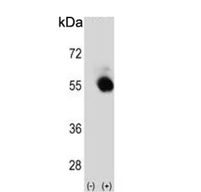SBP Antibody / Selenium Binding Protein / SELENBP1 - image 1