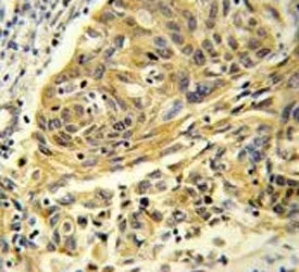 Clathrin Light Chain A Antibody - image 1