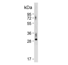 Thyroxine 5-deiodinase Antibody / DIO3 - image 1