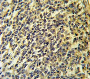 PLA2G6 Antibody / CaI-PLA2 - image 1