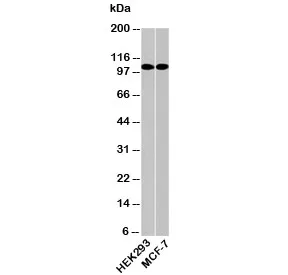 LSD1 Antibody / Lysine-Specific Demethylase 1 - image 1
