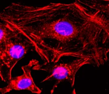 Beta Actin Recombinant Antibody - image 1