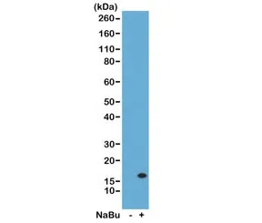 H3K14ac Recombinant Antibody / Acetyl Histone H3 Lysine 14 - image 1