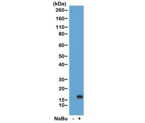 H3K36ac Recombinant Antibody / Acetyl Histone H3 Lysine 36 - image 1