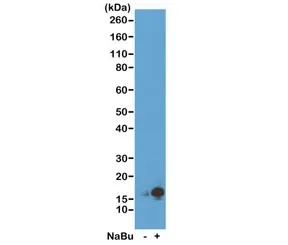 H3K9ac Recombinant Antibody / Acetyl Histone H3 Lysine 9 - image 1