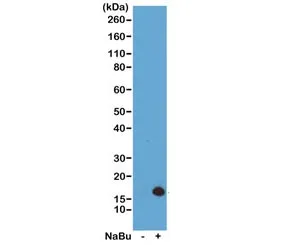 H3K4ac Recombinant Antibody / Acetyl Histone H3 Lysine 4 - image 1