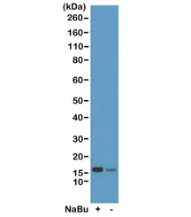 H2BK20ac Recombinant Antibody / Acetyl Histone H2B Lysine 20 - image 1