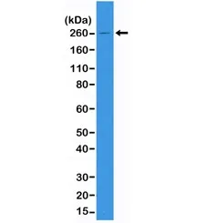 ACC Recombinant Antibody / Acetyl CoA Carboxylase - image 1