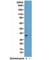 p38 MAPK Recombinant Antibody (pThr180/pTyr182) - image 1