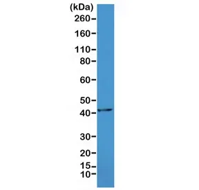 Alpha Actin Recombinant Antibody / ACTA2 (smooth muscle) - image 1