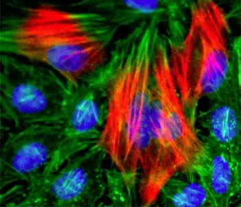Calponin 1 Recombinant Antibody - image 1
