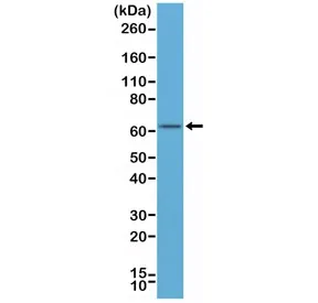 Estrogen Receptor alpha Recombinant Antibody / N-Terminal Region - image 1
