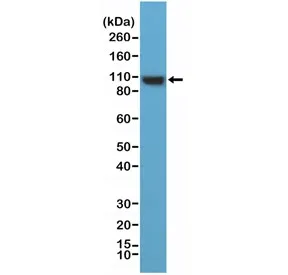 ACTN4 Recombinant Antibody / Alpha Actinin 4 / N-Terminal - image 1