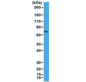 p63 Recombinant Antibody / Tumor protein 63 - image 1