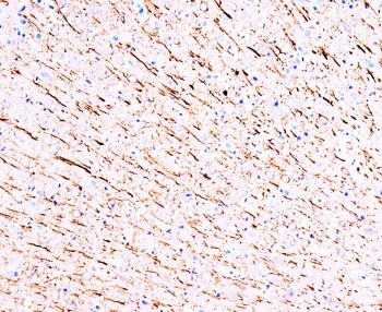 MAP1 Antibody - image 1