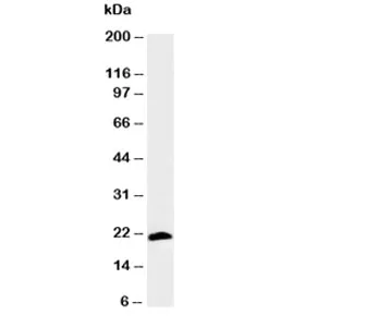Myosin Antibody (Skeletal Fast) - image 1