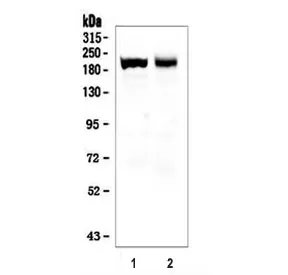 Myosin Antibody Skeletal Slow - image 1