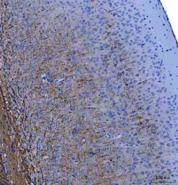 Neurofilament Antibody (Light) - image 1