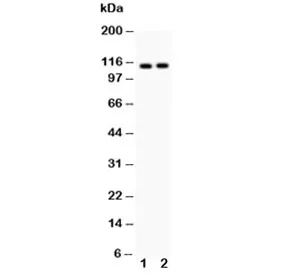 ATP2A2 Antibody - image 1