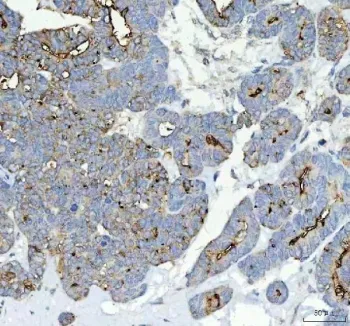 Alkaline Phosphatase Antibody (tissue-nonspecific) - image 1