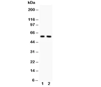 Alkaline Phosphatase Antibody (tissue-nonspecific) - image 1