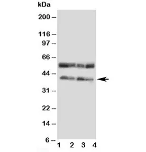CCR5 Antibody - image 1