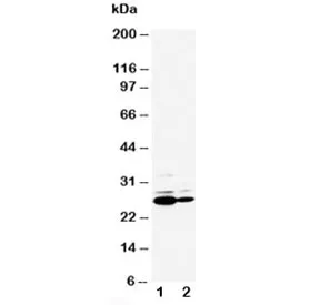 C Reactive Protein Antibody - image 1