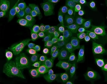 Lamin B1 Antibody - image 1