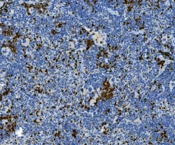Myeloperoxidase Antibody / MPO - image 1