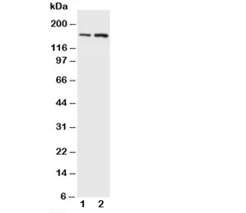 NMDAR2B Antibody - image 1