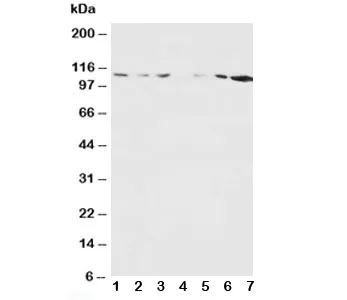 NMDAR1 Antibody - image 1