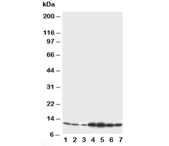 S100 beta Antibody - image 1