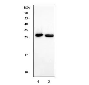 Carbonic Anhydrase I Antibody - image 1