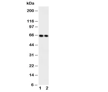 CaMKK2 Antibody - image 1
