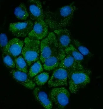 Cystathionase Antibody (Cystathionine gamma lyase) - image 1