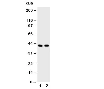 HDAC8 Antibody - image 1