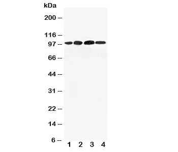 Mineralocorticoid Receptor Antibody - image 1
