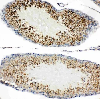 TIM-1 Antibody (KIM-1) - image 1