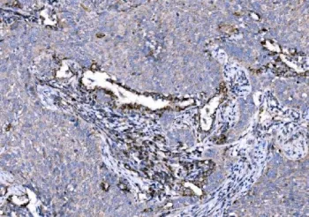 5HT1A Receptor Antibody - image 1