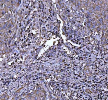 NLRP3 Antibody (NALP3) - image 1