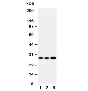 Oncostatin M Antibody - image 1