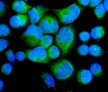 Myosin Phosphatase Antibody - image 1