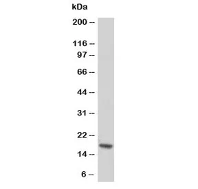 Troponin C Antibody / TNNC1 - image 1