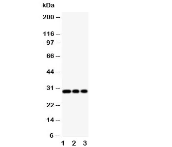 HLA-DM Antibody (beta chain) - image 1