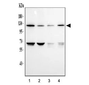 DDR1 Antibody - image 1
