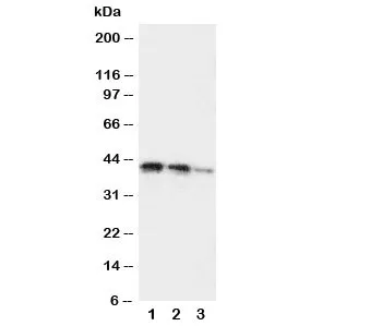 DDR2 Antibody - image 1